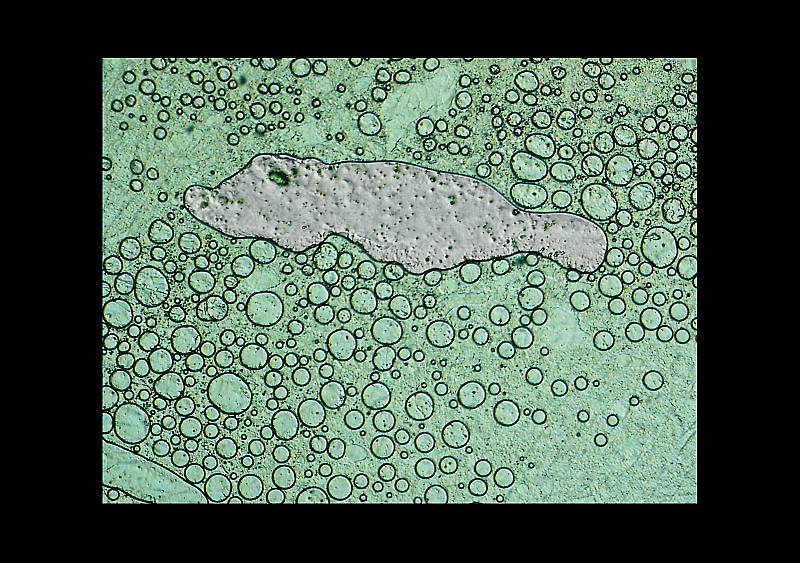 J�rgen Breit "Am�be"